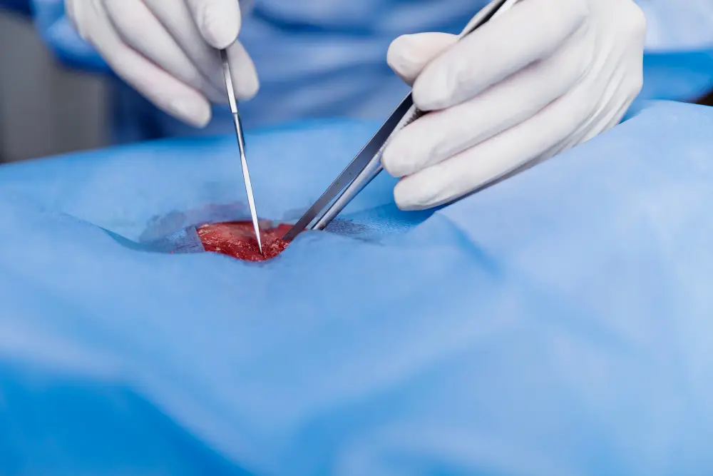 Minimally Invasive General Surgery